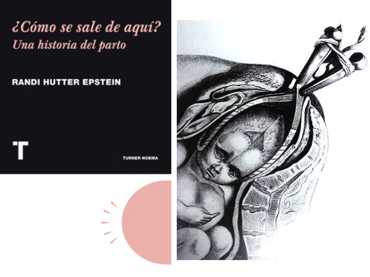 ¿Como se sale de aquí?  – Una historia objetiva de la obstetricia moderna